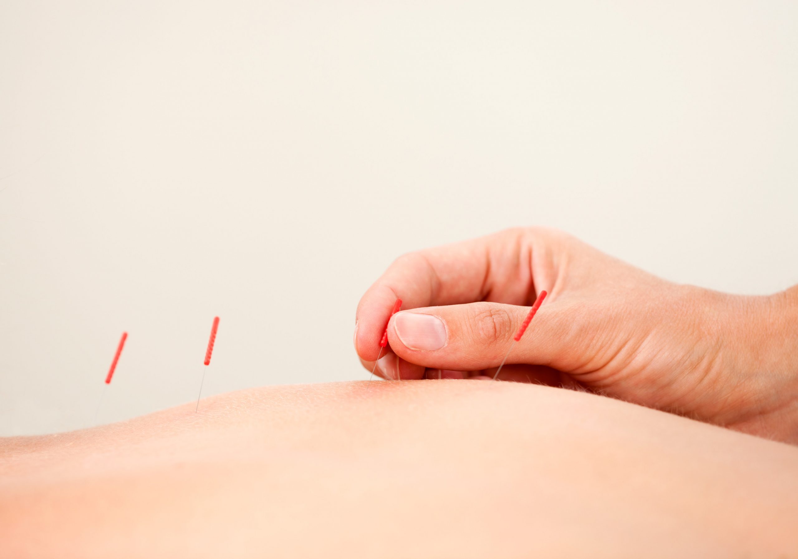 physio health mississauga